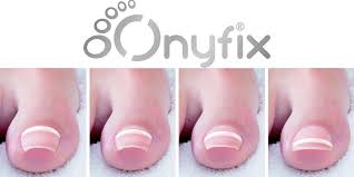 mobile-foot-care-services